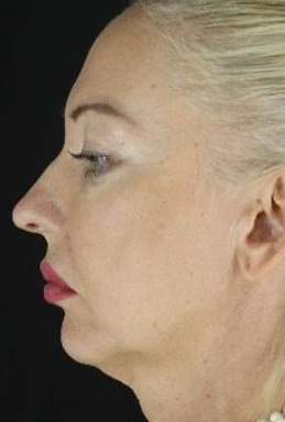 before-after-portrait-woman-retouched 3 before-after-portrait-woman-retouched 3