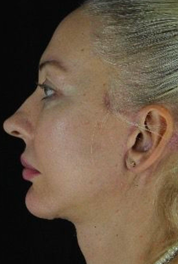 before-after-portrait-woman-retouched 4